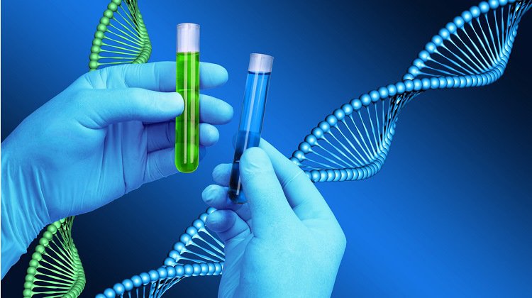 DNA 검사