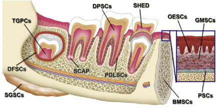 치과 줄기 세포