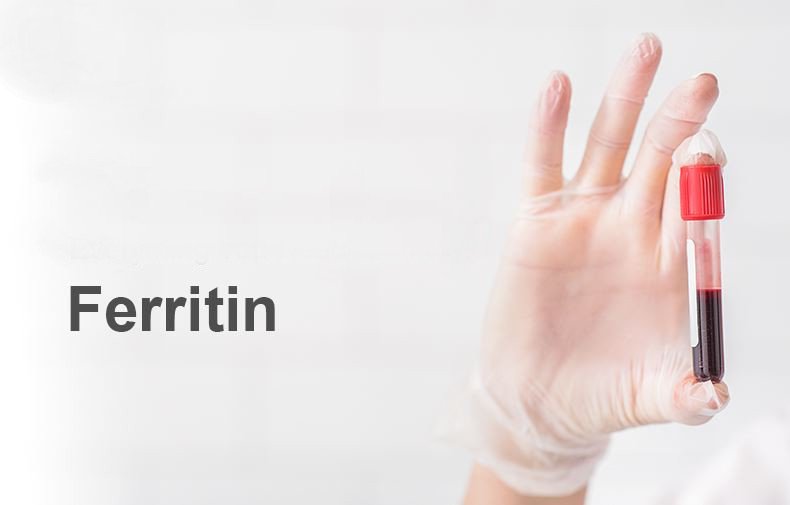 혈청 페리틴은 철 결핍성 빈혈 검사 중 하나입니다.