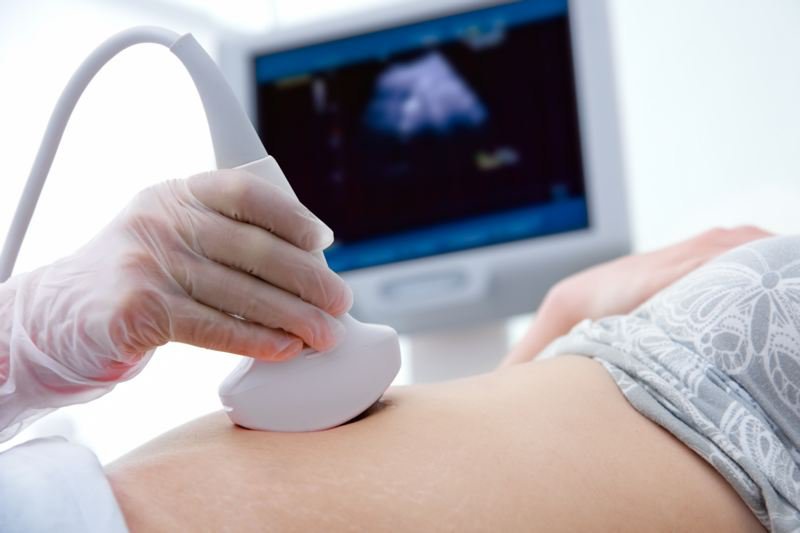 무엇을 위한 태아 심장초음파 검사입니까?