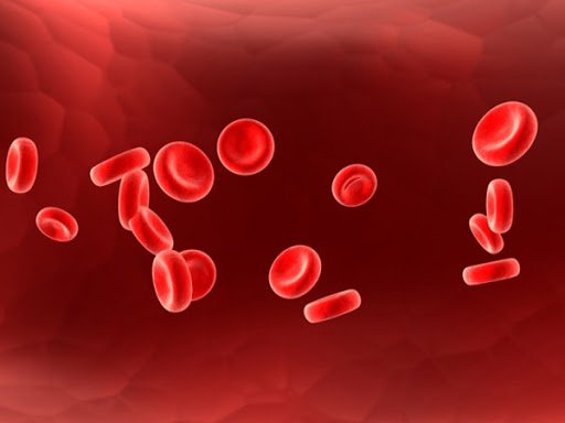 철 결핍 성 빈혈