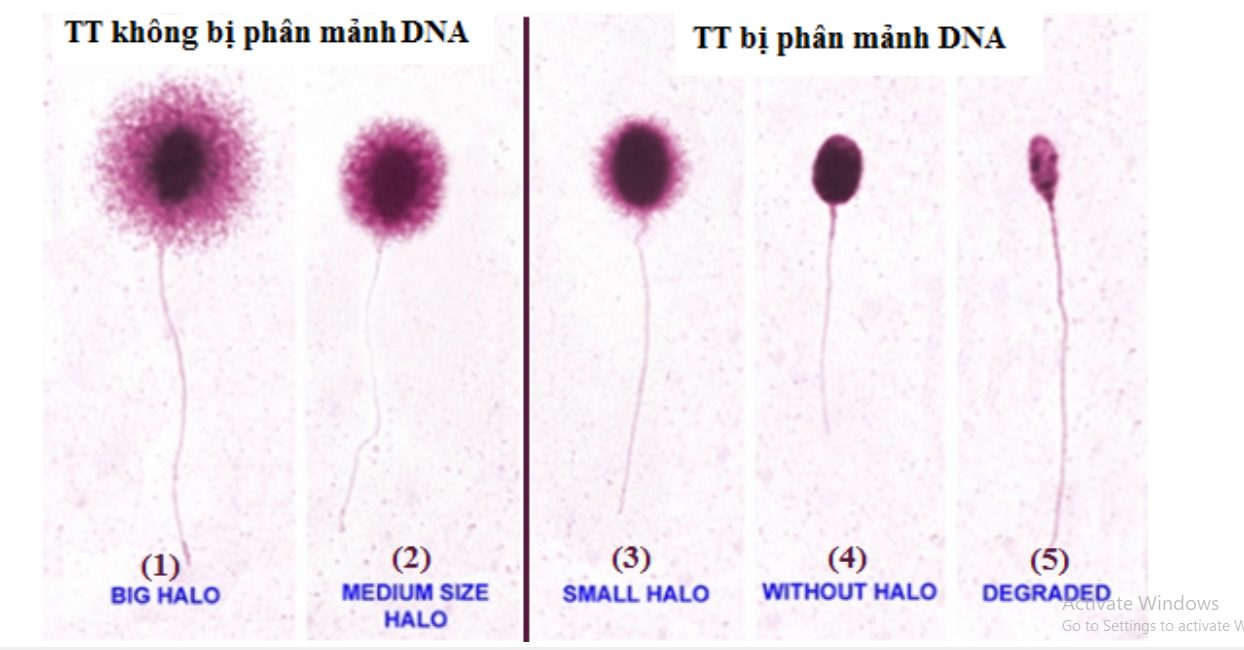 정자 DNA의 단편화