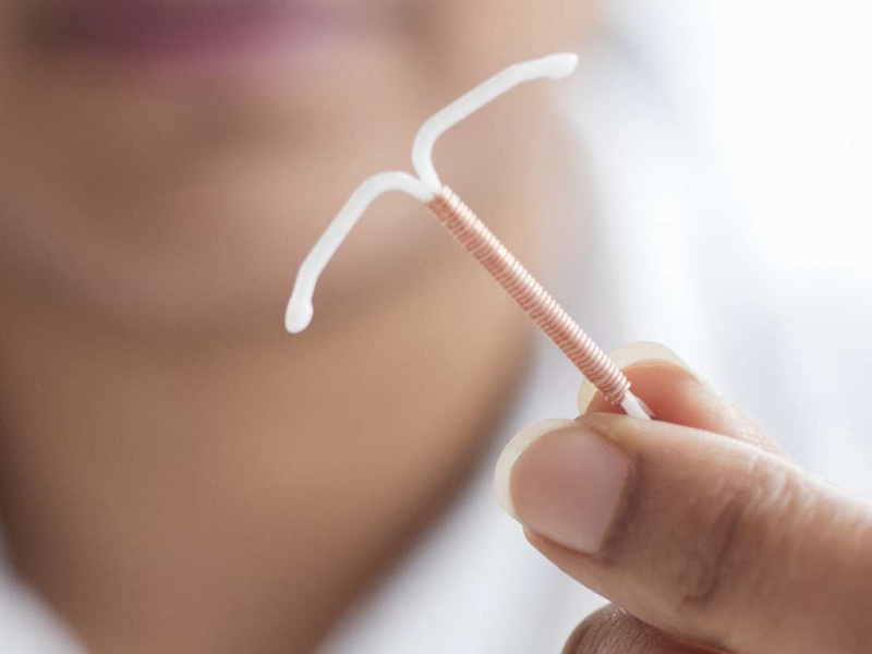 IUD 삽입 후 자궁 천공