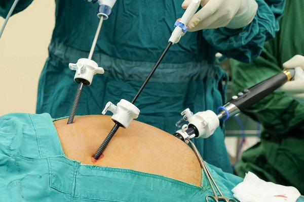 복강경 수술은 자궁외 임신의 가장 일반적인 치료법입니다.