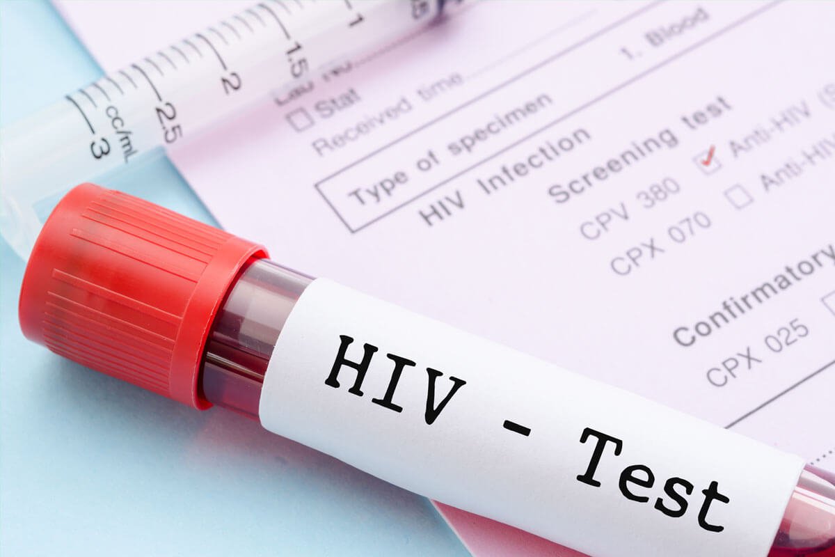 HIV 검사