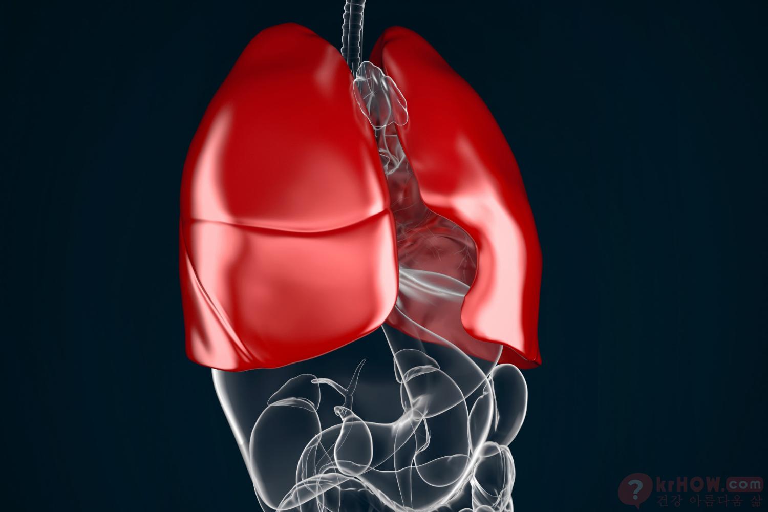 폐 낭종은 폐 조직 내에 형성되는 공기 또는 액체로 채워진 비정상적인 주머니입니다.