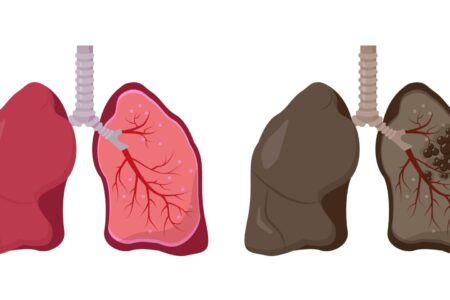 폐 낭종은 폐 조직 내에 형성되는 비정상적인 공기 또는 액체로 채워진 주머니 모양의 공간입니다.