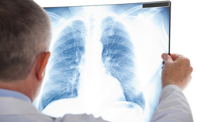 심근염 진단에 심전도와 흉부 X-레이가 필요한 이유는 무엇입니까?
