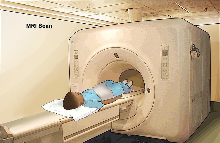 MRI 스캔은 의사가 어린이의 뇌졸증을 진단하는 데 도움이 됩니다.