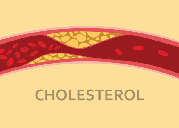 신체에 콜레스테롤이 필요한 이유는 무엇입니까?
