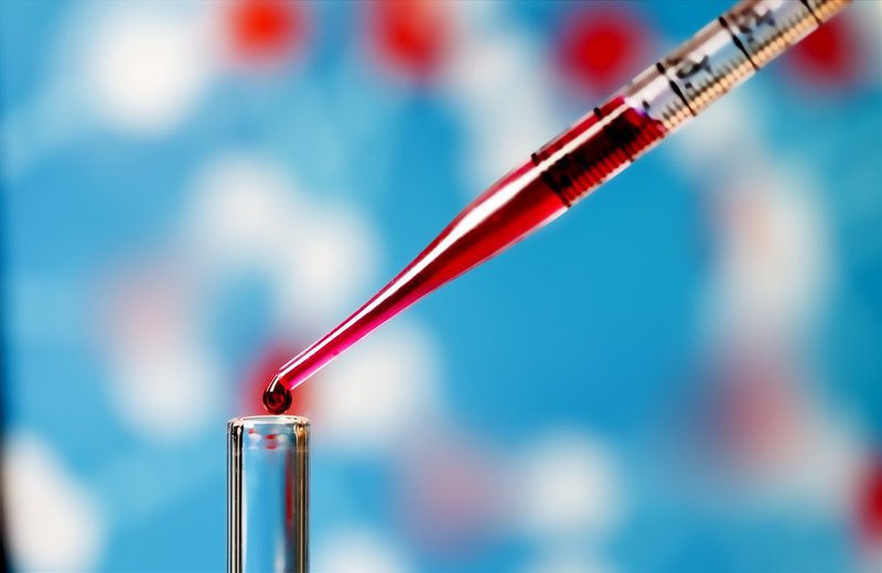 완전한 혈액 세포 분석 테스트