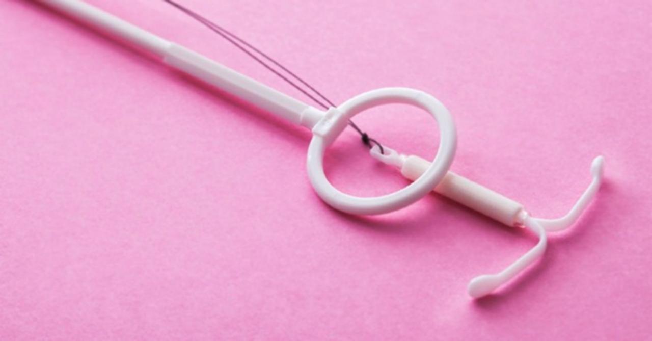 임신을 예방하기 위한 IUD의 부작용